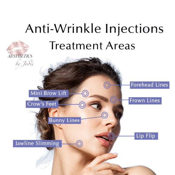 Anti Wrinkle Injection Treatment Areas 2022